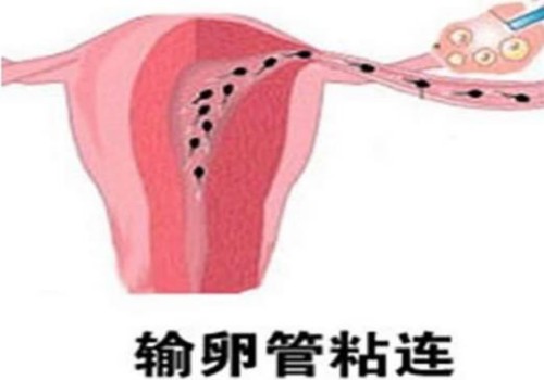 深圳助孕机构：滋肾育胎丸有必要吃吗,早期吃滋肾育胎丸有坏处吗