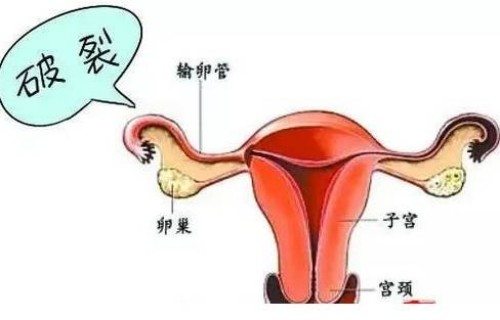 深圳试管婴儿价格：新生儿感冒的症状有哪些,家长应如何护理
