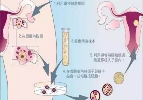 产检所有的项目都要做吗？没必要的项目能不能不做