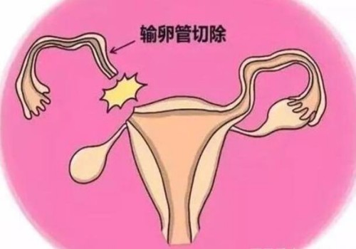 深圳助孕公司：江苏私人医院试管技术可靠吗,私人医院的精准治疗方式